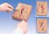 Life/form® Episiotomy Suture Set
