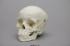 Human Child Skull 5-year-old, Mixed Dentition Exposed and Calvarium Cut