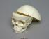 Human Child Skull 5-year-old, Calvarium Cut
