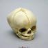 Human Fetal Skull 40 1/2 Weeks (Full Term)