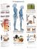 3B Scientific® Osteoporosis Chart