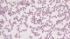 Plasmodium falciparum gametocytes