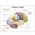 GPI Anatomicals® Basic Half Brain Model