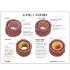 GPI Anatomicals® Artery Model