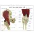 GPI Anatomicals® Mini Joint Set Model, Muscled