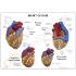 GPI Anatomicals® Heart Disease Model Set
