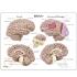 GPI Anatomicals® Brain in Skull Pathologies Model