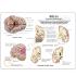 GPI Anatomicals® Brain in Skull Pathologies Model