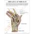 GPI Anatomicals® Rhumatoid Arthritis Hand