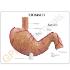 GPI Anatomicals® Stomach Cancer