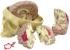 GPI Anatomicals® Brain in Skull Pathologies Model