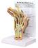 GPI Anatomicals® Rhumatoid Arthritis Hand