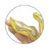 GPI Anatomicals® Rhumatoid Arthritis Hand